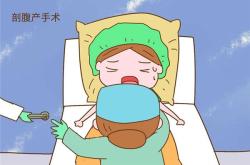 剖腹产有必要选日子吗